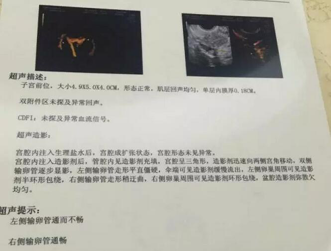 广州最新代妈，广州第三代试管婴儿流程