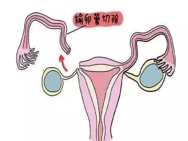 广州供卵试管助孕机构(供卵试管助孕机构)