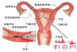 郑州助孕产子价,郑州第三代试管婴儿助孕前需要注意什么？